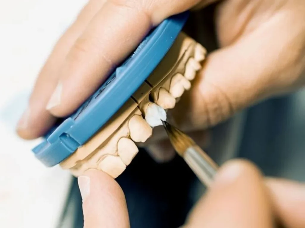 Dental technician applying detailed brushwork to a dental restoration